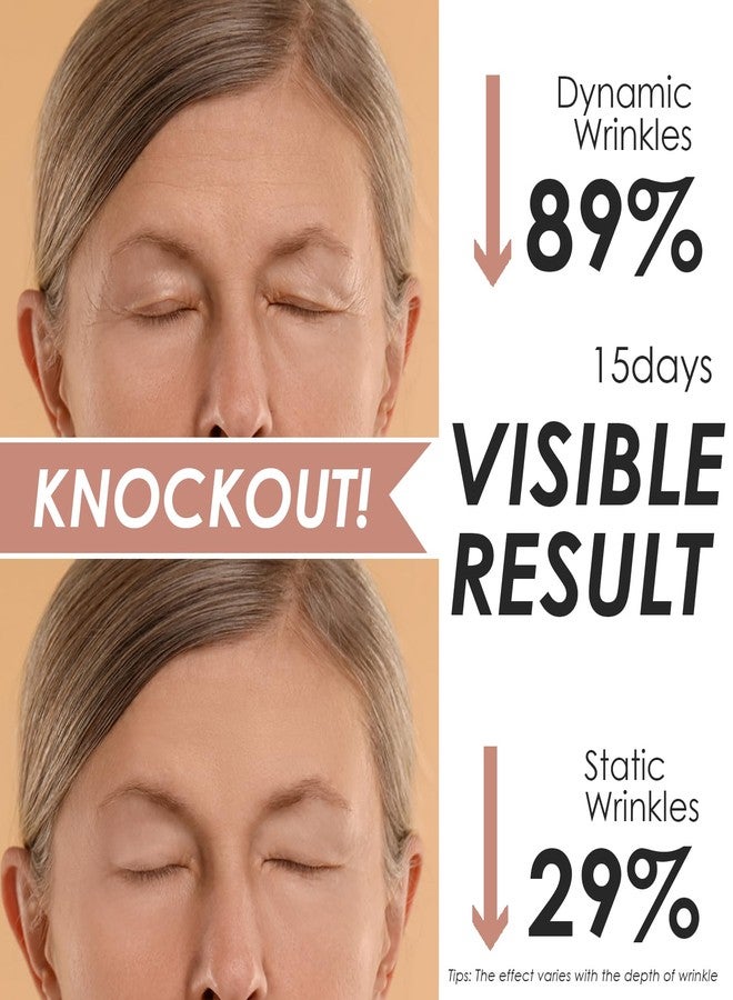 Akissos Forehead Wrinkle Patches Overnight (15 Pack) - Deep Wrinkle Repair from Fascia Layer,Micro Lift Elastic Facial Patches, Face Tape for Sleeping, Hypoallergenic Elasticity Cotton for Forehead Firming - Image 5